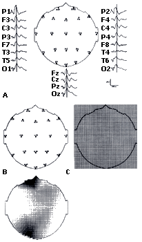 hspace=5